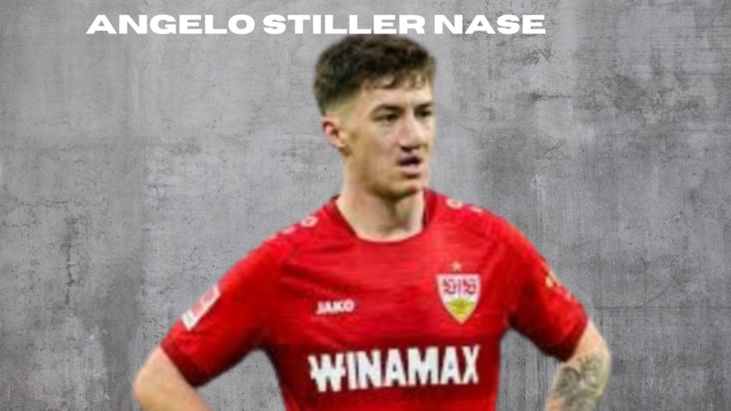 angelo stiller nase